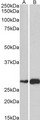 ATF5 Antibody - Goat Anti-ATF5 Antibody (1µg/ml) staining of Mouse (A) and Rat (B) Skeletal Muscle lysate (35µg protein in RIPA buffer). Primary incubation was 1 hour. Detected by chemiluminescencence.