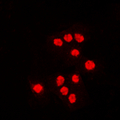 ATF7 Antibody - Immunofluorescent analysis of ATF7 staining in Jurkat cells. Formalin-fixed cells were permeabilized with 0.1% Triton X-100 in TBS for 5-10 minutes and blocked with 3% BSA-PBS for 30 minutes at room temperature. Cells were probed with the primary antibody in 3% BSA-PBS and incubated overnight at 4 C in a humidified chamber. Cells were washed with PBST and incubated with a DyLight 594-conjugated secondary antibody (red) in PBS at room temperature in the dark. DAPI was used to stain the cell nuclei (blue).