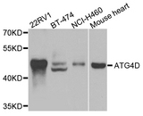 ATG4D Antibody - Western blot analysis of extracts of various cells.