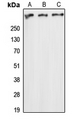 ATM Antibody - Western blot analysis of ATM expression in HEK293T (A); Raw264.7 (B); H9C2 (C) whole cell lysates.