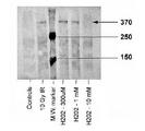 ATM Antibody - Western blot of ATM-kinase, using ATM Kinase (Ser1981) antibody. Sample: Irradiated or peroxidated human fibroblasts.  This image was taken for the unconjugated form of this product. Other forms have not been tested.