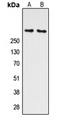 ATM Antibody - Western blot analysis of ATM (pS1981) expression in K562 (A); HEK293T UV-treated (B) whole cell lysates.