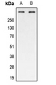 ATM Antibody - Western blot analysis of ATM (pS1987) expression in HEK293T (A); Raw264.7 (B) whole cell lysates.