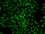ATMIN Antibody - Immunofluorescence analysis of MCF7 cells.