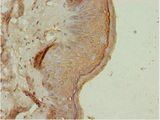 ATMIN Antibody - Immunohistochemistry of paraffin-embedded human skin tissue at dilution 1:100