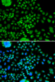 ATOH7 / MATH5 Antibody - Immunofluorescence analysis of MCF7 cells.