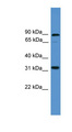 ATOH8 Antibody - ATOH8 antibody Western blot of COLO205 cell lysate. This image was taken for the unconjugated form of this product. Other forms have not been tested.