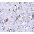 ATOH8 Antibody - Immunohistochemistry of ATOH8 in mouse brain tissue with ATOH8 antibody at 5 µg/mL.