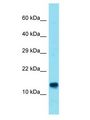 ATP11AUN Antibody - C13orf35 antibody Western Blot of 721_B. Antibody dilution: 1 ug/ml.  This image was taken for the unconjugated form of this product. Other forms have not been tested.