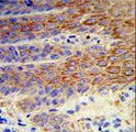 ATP12A Antibody - Formalin-fixed and paraffin-embedded human skin reacted with ATP12A Antibody , which was peroxidase-conjugated to the secondary antibody, followed by DAB staining. This data demonstrates the use of this antibody for immunohistochemistry; clinical relevance has not been evaluated.