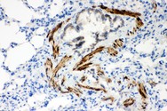 ATP2A2 / SERCA2 Antibody - ATP2A2 antibody IHC-paraffin: Rat Lung Tissue.