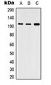 ATP2A2 / SERCA2 Antibody - Western blot analysis of SERCA2 expression in THP1 (A); NIH3T3 (B); PC12 (C) whole cell lysates.
