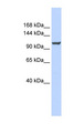 ATP2B4 / PMCA4 Antibody - ATP2B4 / PMCA4 antibody Western blot of 721_B cell lysate. This image was taken for the unconjugated form of this product. Other forms have not been tested.
