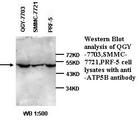 ATP5B / ATP Synthase Beta Antibody