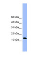 ATP5D Antibody - ATP5D antibody Western blot of Mouse Liver lysate. This image was taken for the unconjugated form of this product. Other forms have not been tested.