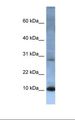ATP5G2 Antibody - Fetal heart lysate. Antibody concentration: 1.0 ug/ml. Gel concentration: 10-20%.  This image was taken for the unconjugated form of this product. Other forms have not been tested.