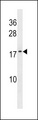ATP5L2 Antibody - ATP5L2 Antibody western blot of WiDr cell line lysates (35 ug/lane). The ATP5L2 antibody detected the ATP5L2 protein (arrow).