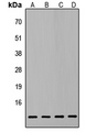 ATP5L2 Antibody - Western blot analysis of ATP5L2 expression in HepG2 (A); PC3 (B); MCF7 (C); NIH3T3 (D) whole cell lysates.