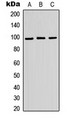 ATP6V0A2 Antibody - Western blot analysis of ATP6V0A2 expression in HEK293T (A); Raw264.7 (B); H9C2 (C) whole cell lysates.