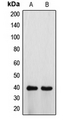 ATP6V0D1 Antibody - Western blot analysis of ATP6V0D1 expression in HeLa (A); H9C2 (B) whole cell lysates.