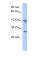 ATP6V0E2 Antibody - ATP6V0E2 antibody Western blot of COLO205 cell lysate. This image was taken for the unconjugated form of this product. Other forms have not been tested.