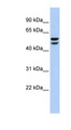 ATP6V1B2 Antibody - ATP6V1B2 antibody Western blot of 721_B cell lysate. This image was taken for the unconjugated form of this product. Other forms have not been tested.
