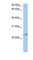 ATP6V1E2 Antibody - ATP6V1E2 antibody Western blot of Fetal Spleen lysate. This image was taken for the unconjugated form of this product. Other forms have not been tested.