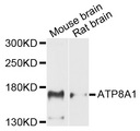 ATP8A1 Antibody - Western blot analysis of extracts of various cells.