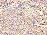 ATP8A1 Antibody - Immunohistochemistry of paraffin-embedded human cervical cancer at dilution of 1:100