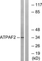 ATPAF2 Antibody - Western blot analysis of lysates from Jurkat cells, using ATPAF2 Antibody. The lane on the right is blocked with the synthesized peptide.