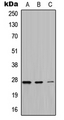 ATPASE6 / ATP6 Antibody - Western blot analysis of ATP6 expression in HeLa (A); A549 (B); PC12 (C) whole cell lysates.