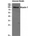 ATXN1 / SCA1 Antibody - Western blot of Ataxin-1 antibody