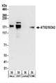 ATXN2 / SCA2 / Ataxin-2 Antibody - Detection of Human and Mouse ATX2/SCA2 by Western Blot. Samples: Whole cell lysate (50 ug) from HeLa, 293T, Jurkat, and mouse TCMK-1 cells. Antibodies: Affinity purified rabbit anti-ATX2/SCA2 antibody used for WB at 0.4 ug/ml. Detection: Chemiluminescence with an exposure time of 3 minutes.