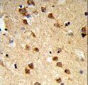 ATXN3 / JOS Antibody - Formalin-fixed and paraffin-embedded human brain tissue reacted with ATXN3 Antibody , which was peroxidase-conjugated to the secondary antibody, followed by DAB staining. This data demonstrates the use of this antibody for immunohistochemistry; clinical relevance has not been evaluated.