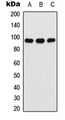 ATXN7 / SCA7 / Ataxin-7 Antibody - Western blot analysis of Ataxin 7 expression in A549 (A); NIH3T3 (B); PC12 (C) whole cell lysates.