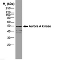 AURKA / Aurora-A Antibody - Recombinant Aurora kinase detected with Mouse anti-Aurora-A kinase (MOUSE ANTI AURORA-A KINASE).  This image was taken for the unconjugated form of this product. Other forms have not been tested.