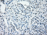 AURKC / Aurora C Antibody - IHC of paraffin-embedded endometrium tissue using anti-AURKC mouse monoclonal antibody. (Dilution 1:50).