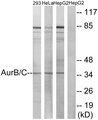 Aurora Kinase B+C Antibody - Western blot analysis of lysates from 293, HeLa, and fHepG2 cells, treated with Paclitaxel 1uM 24h, using AurB/C Antibody. The lane on the right is blocked with the synthesized peptide.