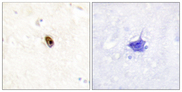 Aurora Kinase B+C Antibody - Immunohistochemistry analysis of paraffin-embedded human brain, using AurB/C (Phospho-Thr236/202) Antibody. The picture on the right is blocked with the phospho peptide.
