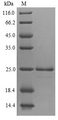 Endochitinase Protein - (Tris-Glycine gel) Discontinuous SDS-PAGE (reduced) with 5% enrichment gel and 15% separation gel.