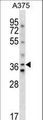 AVPR1A / V1a Receptor Antibody - AVPR1A Antibody western blot of A375 cell line lysates (35 ug/lane). The AVPR1A antibody detected the AVPR1A protein (arrow).