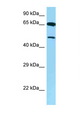 AVPR1B Antibody - AVPR1B antibody Western blot of 8226 Cell lysate. Antibody concentration 1 ug/ml.  This image was taken for the unconjugated form of this product. Other forms have not been tested.
