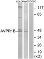 AVPR1B Antibody - Western blot of extracts from COLO/HepG2 cells, using AVPR1B Antibody. The lane on the right is treated with the synthesized peptide.