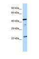 AVPR1B Antibody - AVPR1B antibody Western blot of Fetal Brain lysate. Antibody concentration 1 ug/ml.  This image was taken for the unconjugated form of this product. Other forms have not been tested.