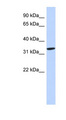AZGP1 / ZAG Antibody - AZGP1 antibody Western blot of Fetal Heart lysate. This image was taken for the unconjugated form of this product. Other forms have not been tested.
