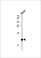 B2M / Beta 2 Microglobulin Antibody - B2M Antibody western blot of HeLa cell line lysates (35 ug/lane). The B2M antibody detected the B2M protein (arrow).