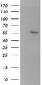B3GALNT2 Antibody - HEK293T cells were transfected with the pCMV6-ENTRY control (Left lane) or pCMV6-ENTRY B3GALNT2 (Right lane) cDNA for 48 hrs and lysed. Equivalent amounts of cell lysates (5 ug per lane) were separated by SDS-PAGE and immunoblotted with anti-B3GALNT2.