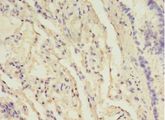 B3GNT5 Antibody - Immunohistochemistry of paraffin-embedded human lung using antibody at 1:100 dilution.  This image was taken for the unconjugated form of this product. Other forms have not been tested.