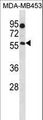 B4GALNT1 / GM2/GD2 Synthase Antibody - B4GALNT1 Antibody western blot of MDA-MB453 cell line lysates (35 ug/lane). The B4GALNT1 antibody detected the B4GALNT1 protein (arrow).