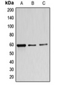 B4GALNT1 / GM2/GD2 Synthase Antibody - Western blot analysis of B4GALNT1 expression in MDAMB453 (A); A549 (B); K562 (C) whole cell lysates.